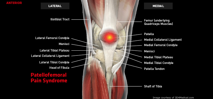 medial knee pain, TAGUAS SIDE HUSTLES